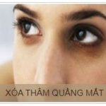 XÓA QUẦNG THÂM MẮT khuyến mại 50% phương pháp xóa quầng thâm mắt